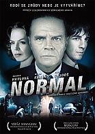 Normal (Digipack)