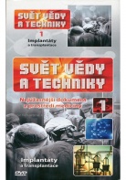 Svět vědy a techniky 1 - Implantáty a transplantace (papírový obal) (DVD)